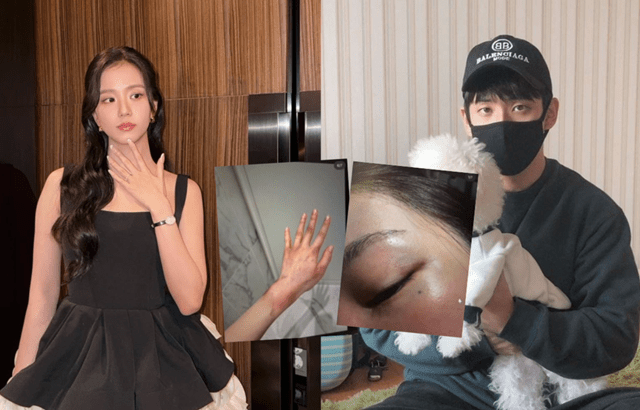 親哥再傳家暴！大嫂曬恐怖傷照「被逼吞痰硬上」 Jisoo慘受牽連…昔曾喊：自己人生自己看著辦